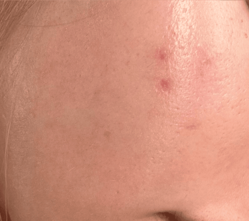 Anonymous - After