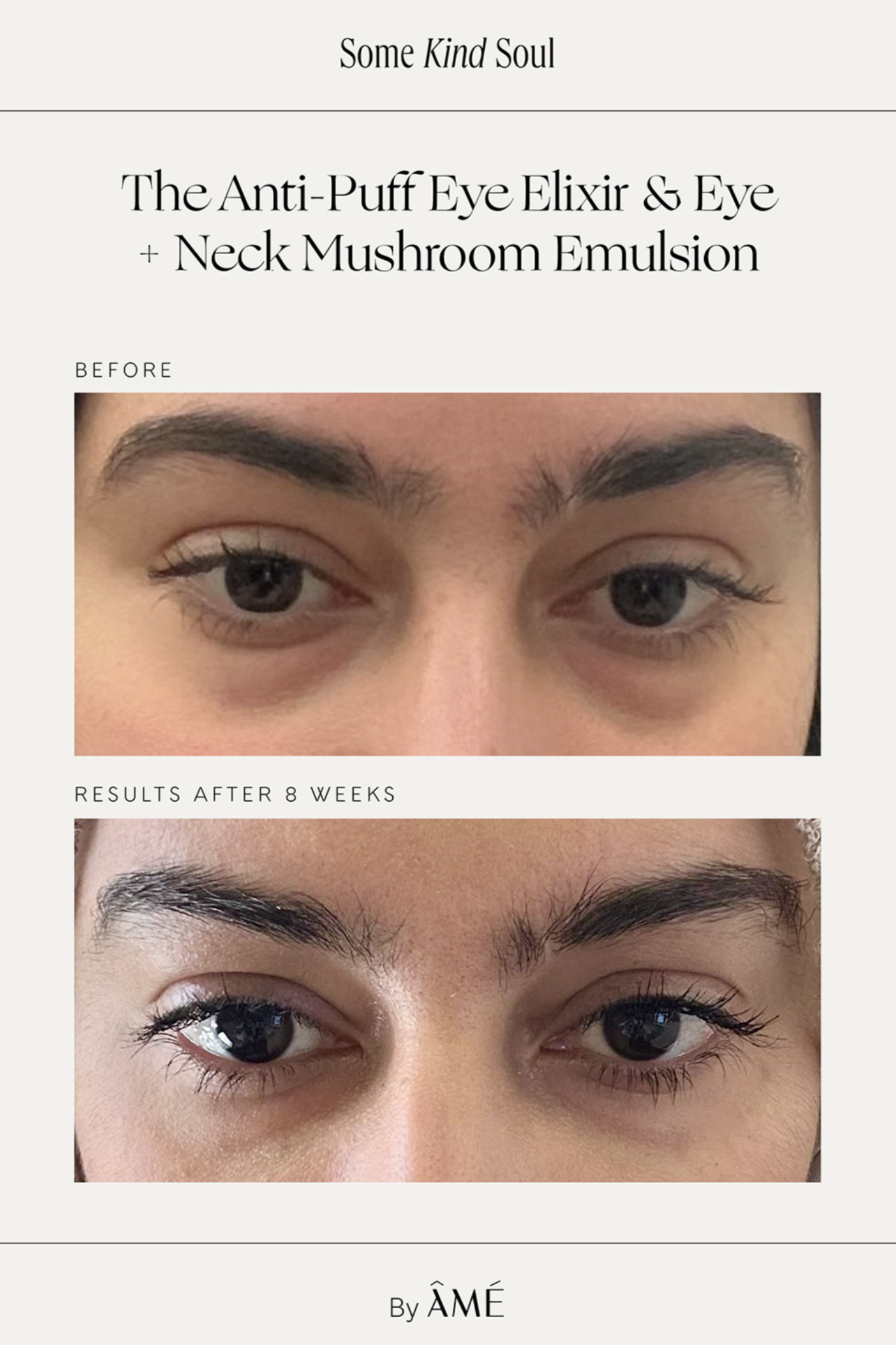 Anti-Puff Eye Elyxir