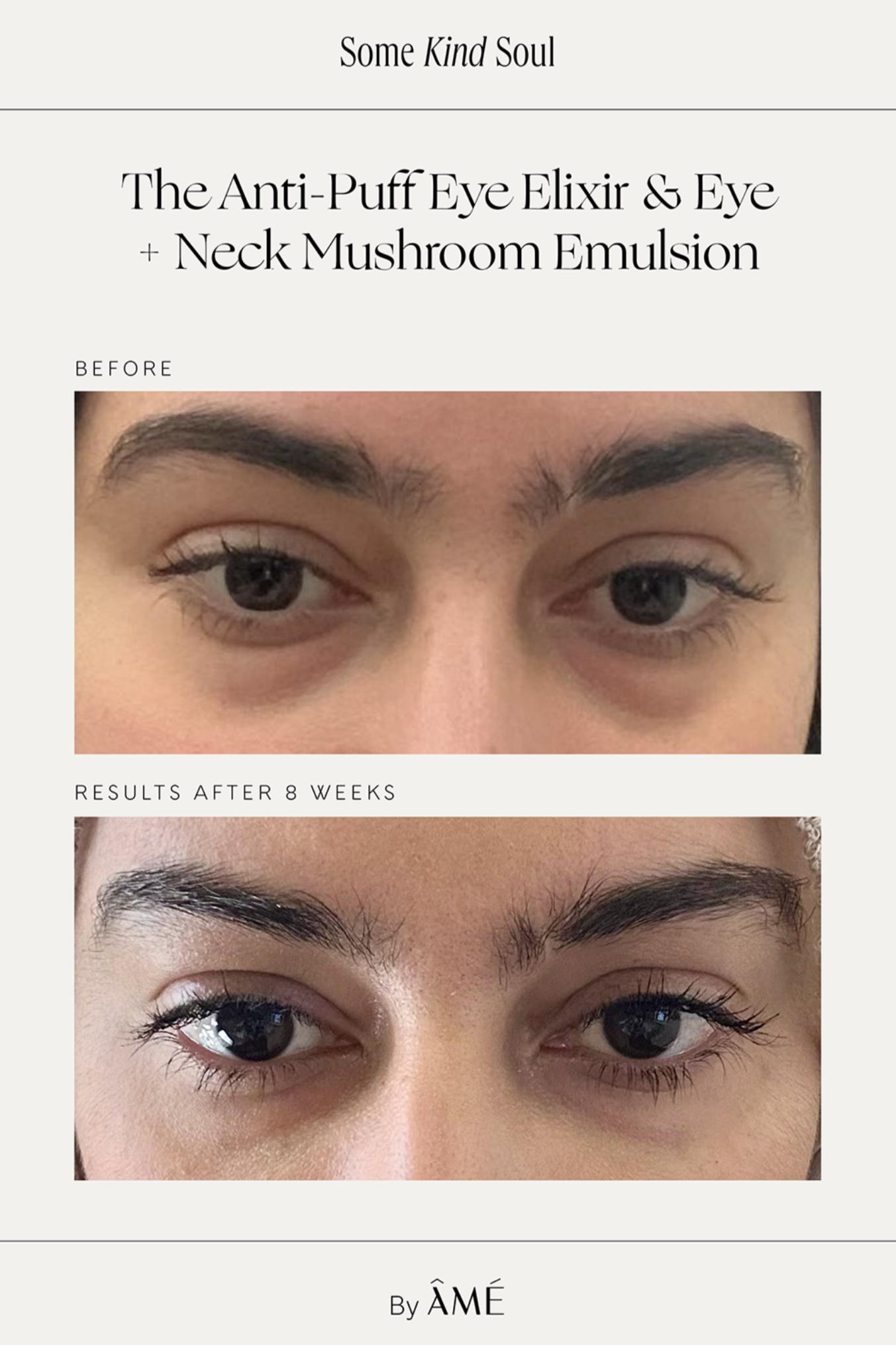 Instant Lift Eye + Neck Mushroom Emulsion