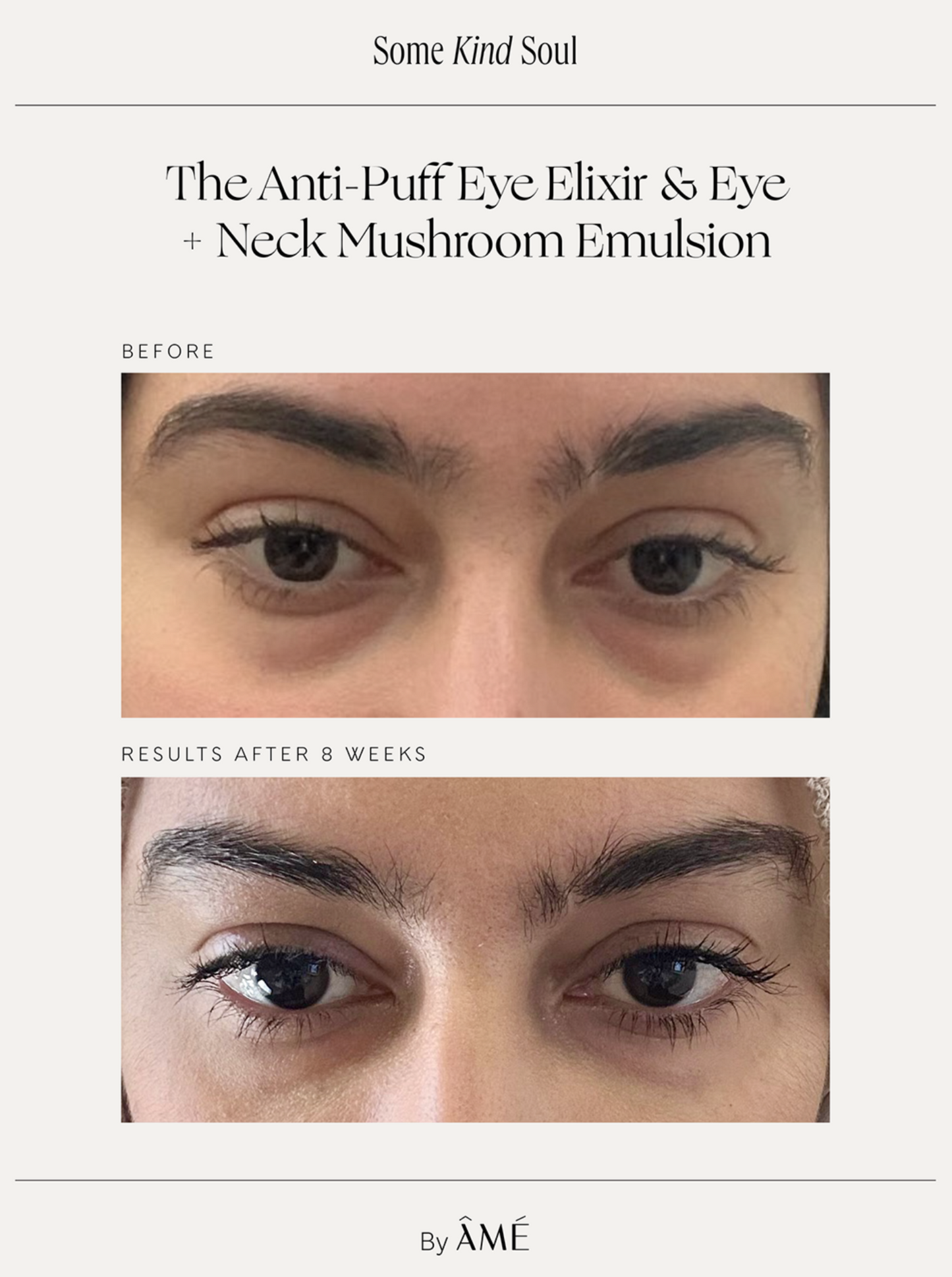 Anti-Puff  Eye Elyxir